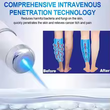 Laser Therapy Leg Repair Pen