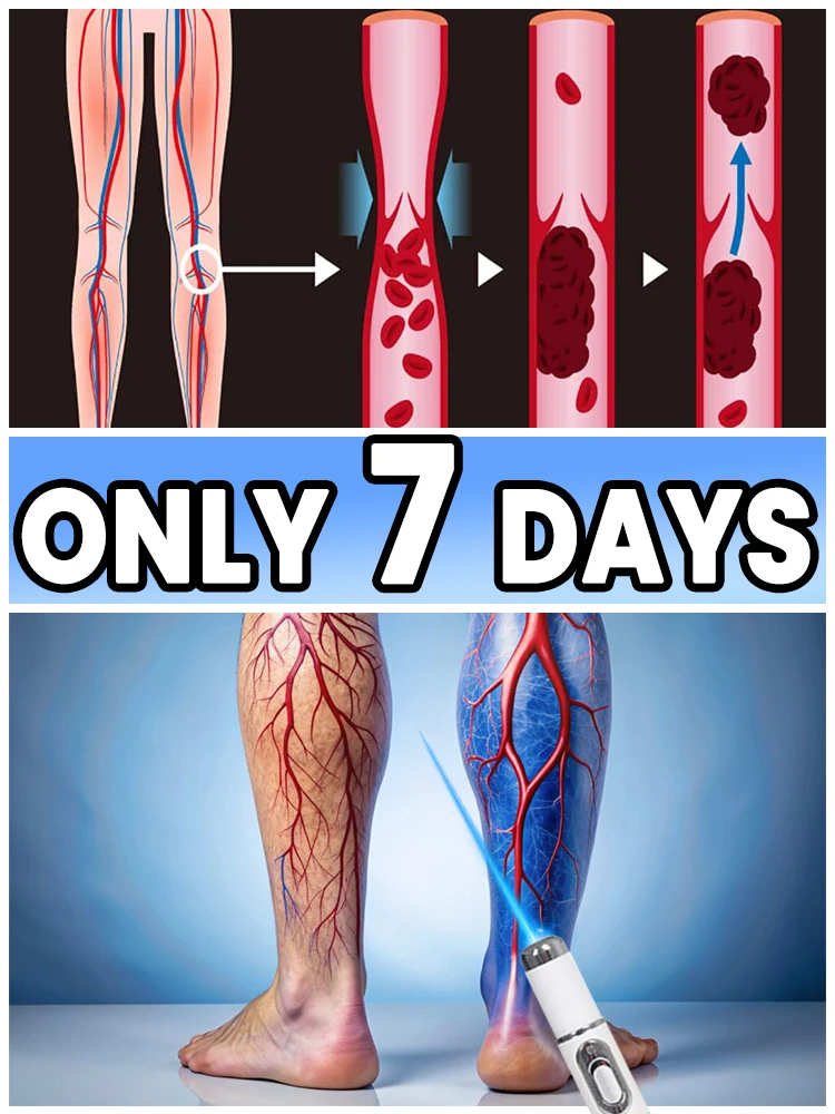 Laser Therapy Leg Repair Pen - Image 2